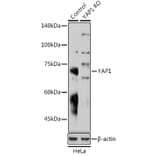 Western Blot - Anti-YAP1 Antibody (A81030) - Antibodies.com