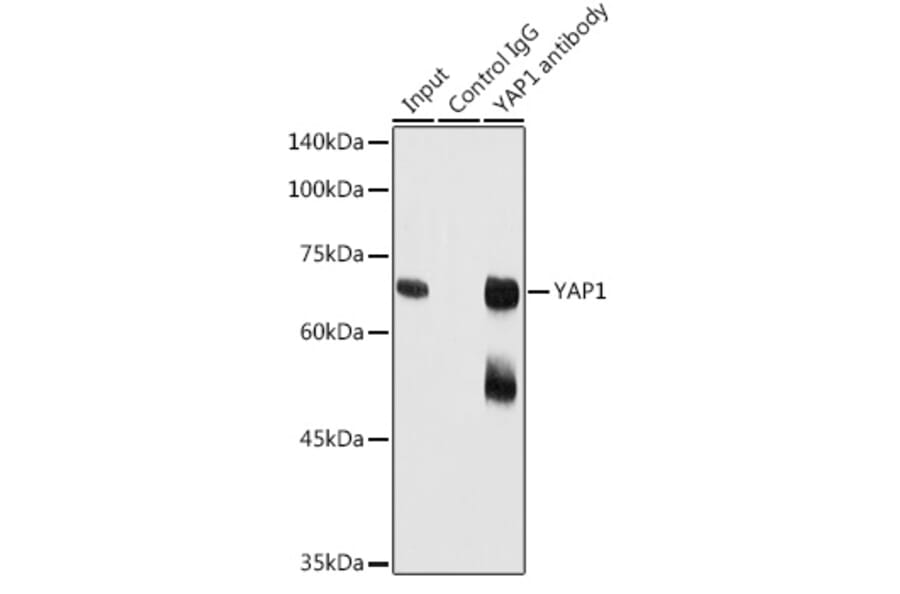 Western Blot - Anti-YAP1 Antibody (A81030) - Antibodies.com