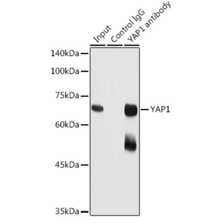 Western Blot - Anti-YAP1 Antibody (A81030) - Antibodies.com