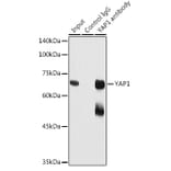 Western Blot - Anti-YAP1 Antibody (A81030) - Antibodies.com