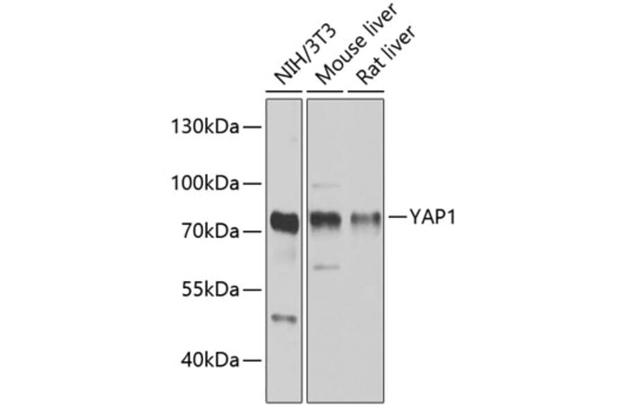 Western Blot - Anti-YAP1 Antibody (A81031) - Antibodies.com