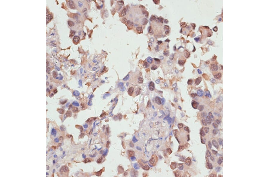 Immunohistochemistry - Anti-YAP1 Antibody (A81031) - Antibodies.com