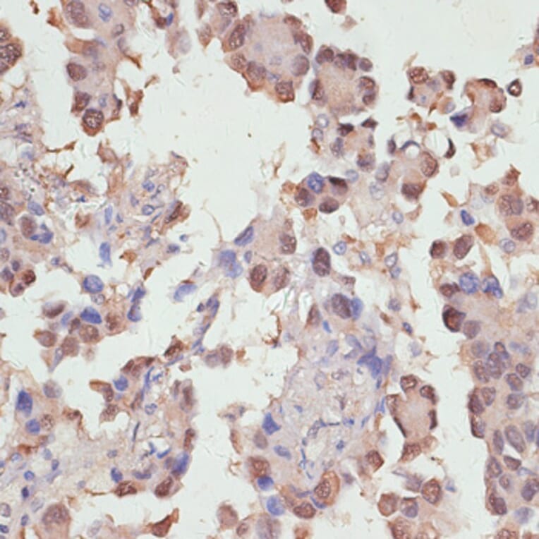 Immunohistochemistry - Anti-YAP1 Antibody (A81031) - Antibodies.com