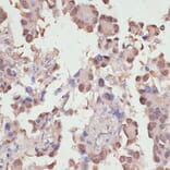 Immunohistochemistry - Anti-YAP1 Antibody (A81031) - Antibodies.com