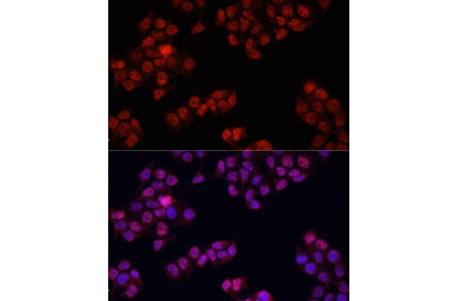 Immunofluorescence - Anti-YAP1 Antibody (A81031) - Antibodies.com