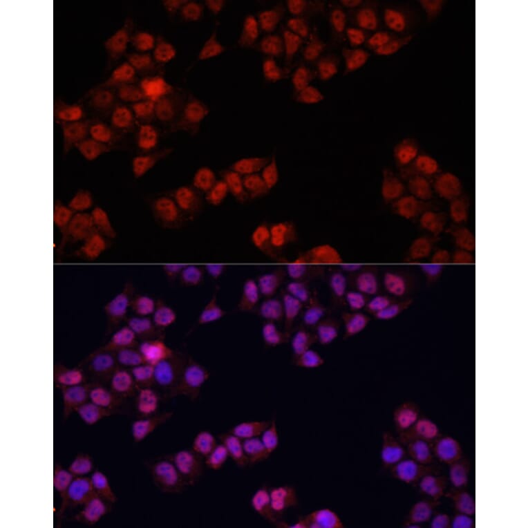 Immunofluorescence - Anti-YAP1 Antibody (A81031) - Antibodies.com