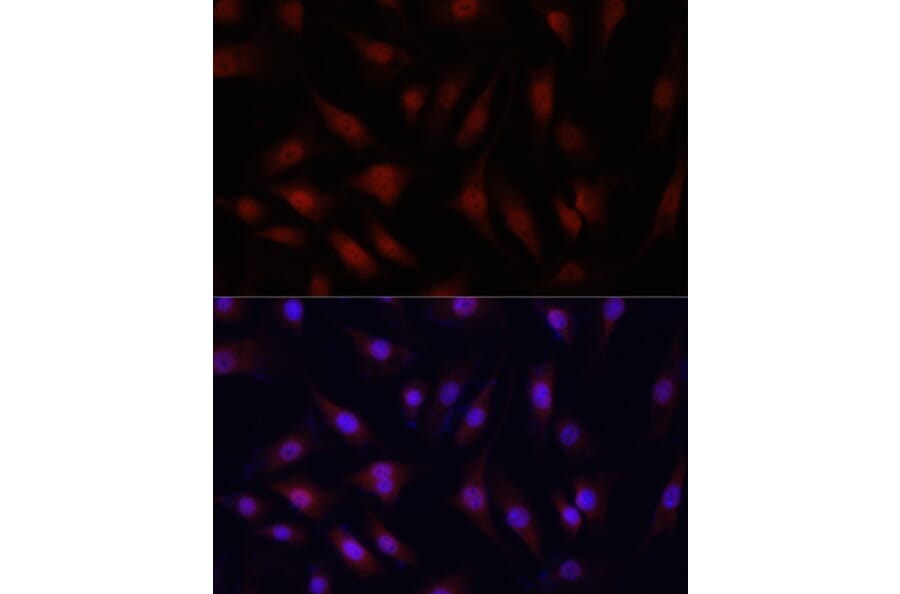 Immunofluorescence - Anti-YAP1 Antibody (A81031) - Antibodies.com