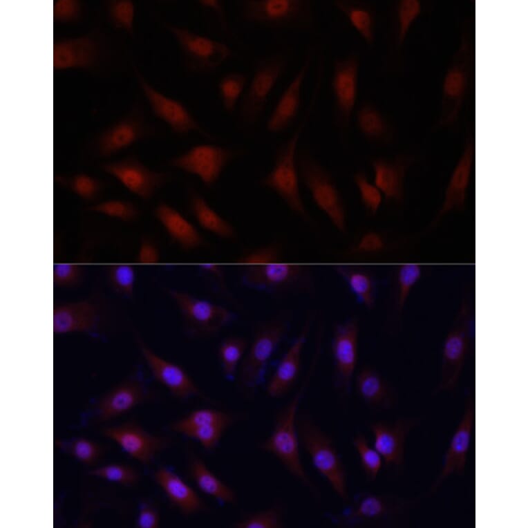 Immunofluorescence - Anti-YAP1 Antibody (A81031) - Antibodies.com