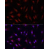 Immunofluorescence - Anti-YAP1 Antibody (A81031) - Antibodies.com