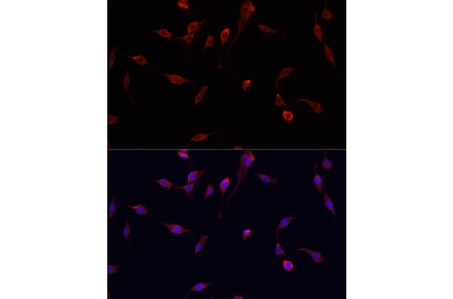 Immunofluorescence - Anti-YAP1 Antibody (A81031) - Antibodies.com