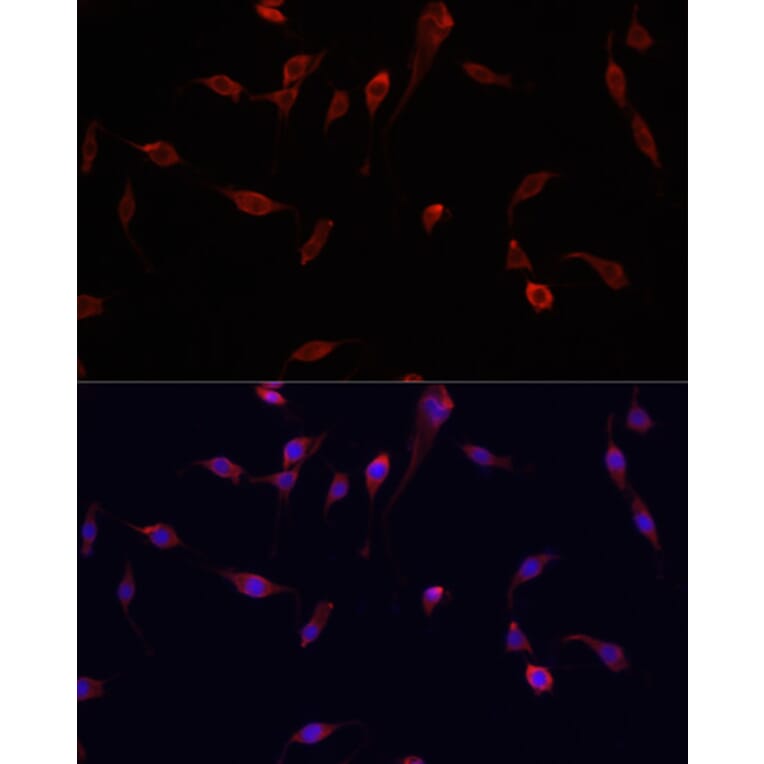 Immunofluorescence - Anti-YAP1 Antibody (A81031) - Antibodies.com