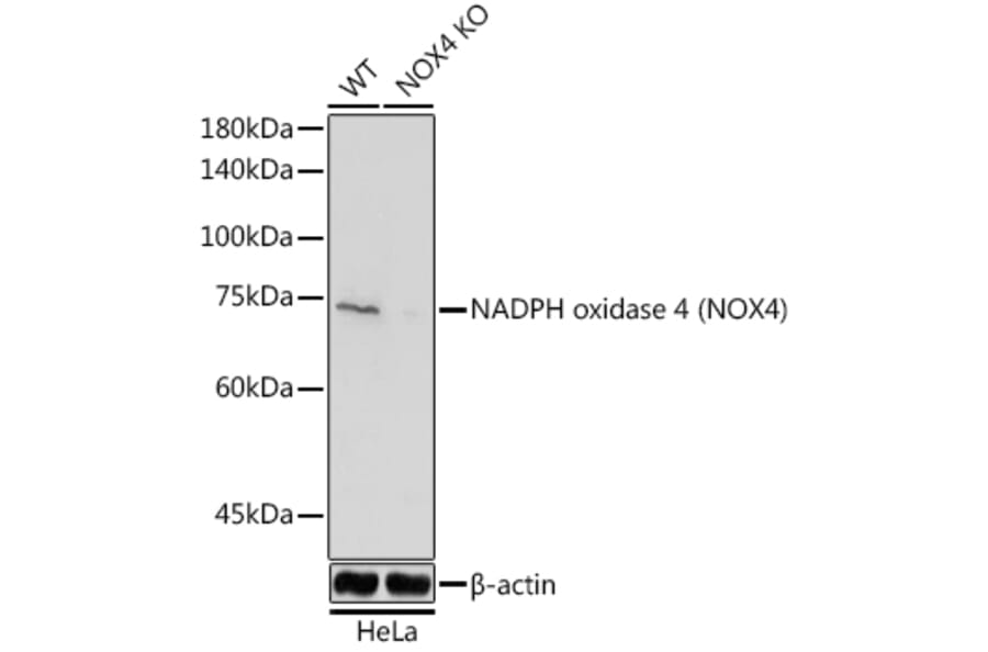 Western Blot - Anti-NADPH oxidase 4 Antibody (A81032) - Antibodies.com