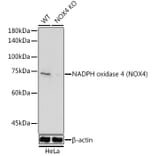 Western Blot - Anti-NADPH oxidase 4 Antibody (A81032) - Antibodies.com