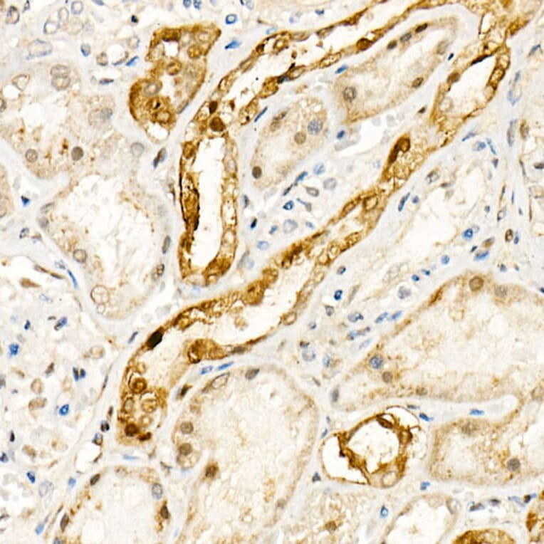 Immunohistochemistry - Anti-NADPH oxidase 4 Antibody (A81032) - Antibodies.com