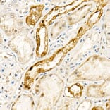 Immunohistochemistry - Anti-NADPH oxidase 4 Antibody (A81032) - Antibodies.com