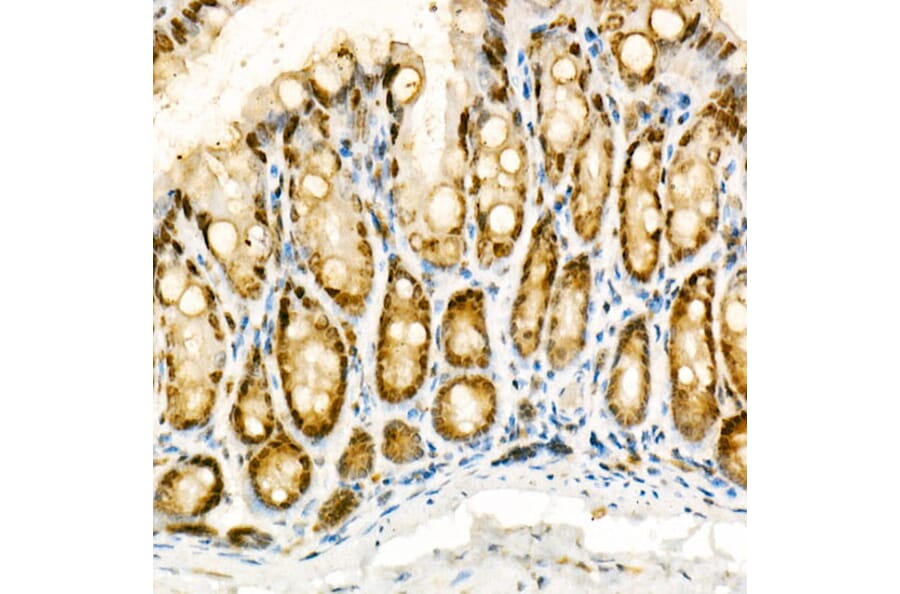 Immunohistochemistry - Anti-NADPH oxidase 4 Antibody (A81032) - Antibodies.com
