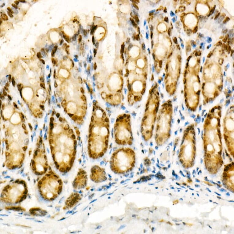 Immunohistochemistry - Anti-NADPH oxidase 4 Antibody (A81032) - Antibodies.com