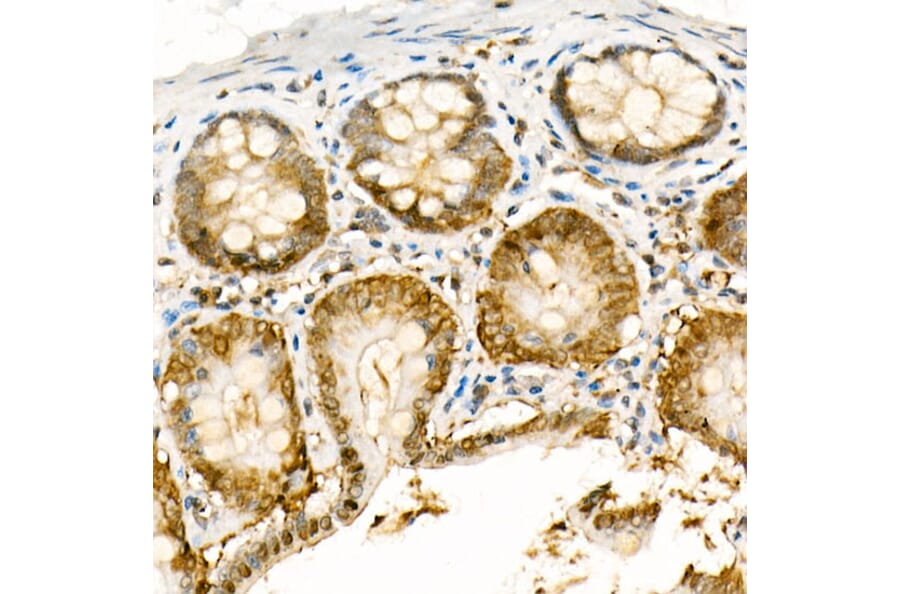 Immunohistochemistry - Anti-NADPH oxidase 4 Antibody (A81032) - Antibodies.com