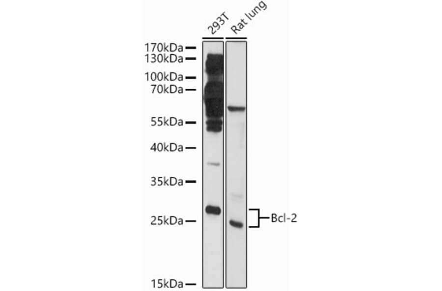 Western Blot - Anti-Bcl-2 Antibody (A81033) - Antibodies.com