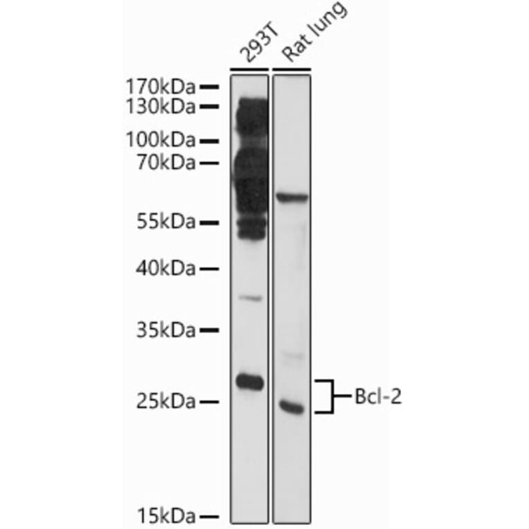 Western Blot - Anti-Bcl-2 Antibody (A81033) - Antibodies.com