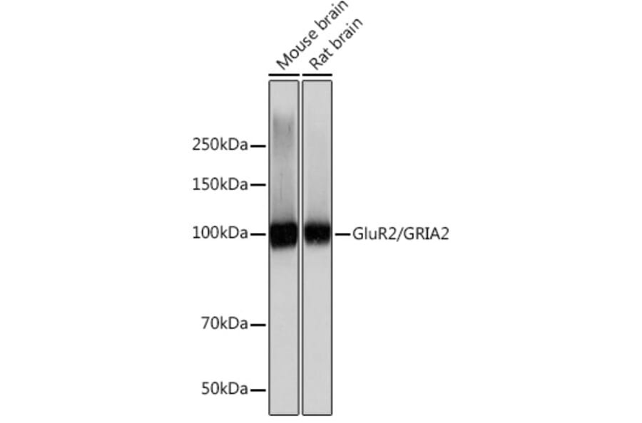 Western Blot - Anti-Ionotropic Glutamate receptor 2 Antibody [ARC0572] (A81034) - Antibodies.com