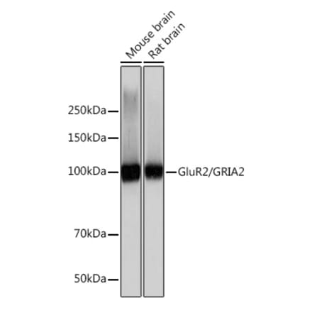 Western Blot - Anti-Ionotropic Glutamate receptor 2 Antibody [ARC0572] (A81034) - Antibodies.com
