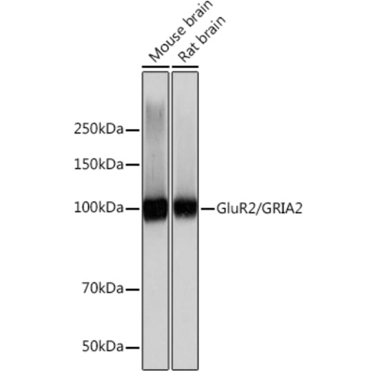 Western Blot - Anti-Ionotropic Glutamate receptor 2 Antibody [ARC0572] (A81034) - Antibodies.com