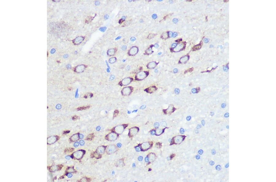 Immunohistochemistry - Anti-Ionotropic Glutamate receptor 2 Antibody [ARC0572] (A81034) - Antibodies.com