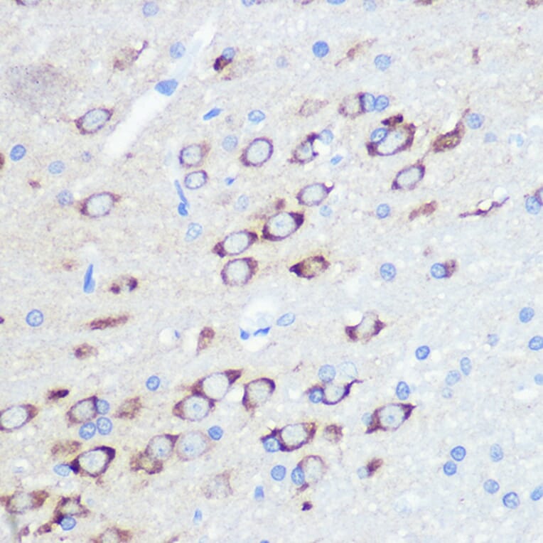 Immunohistochemistry - Anti-Ionotropic Glutamate receptor 2 Antibody [ARC0572] (A81034) - Antibodies.com