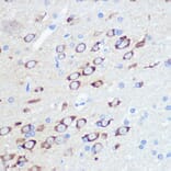 Immunohistochemistry - Anti-Ionotropic Glutamate receptor 2 Antibody [ARC0572] (A81034) - Antibodies.com