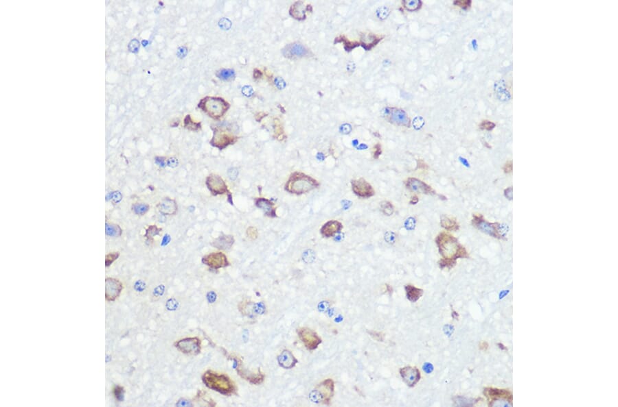 Immunohistochemistry - Anti-Ionotropic Glutamate receptor 2 Antibody [ARC0572] (A81034) - Antibodies.com