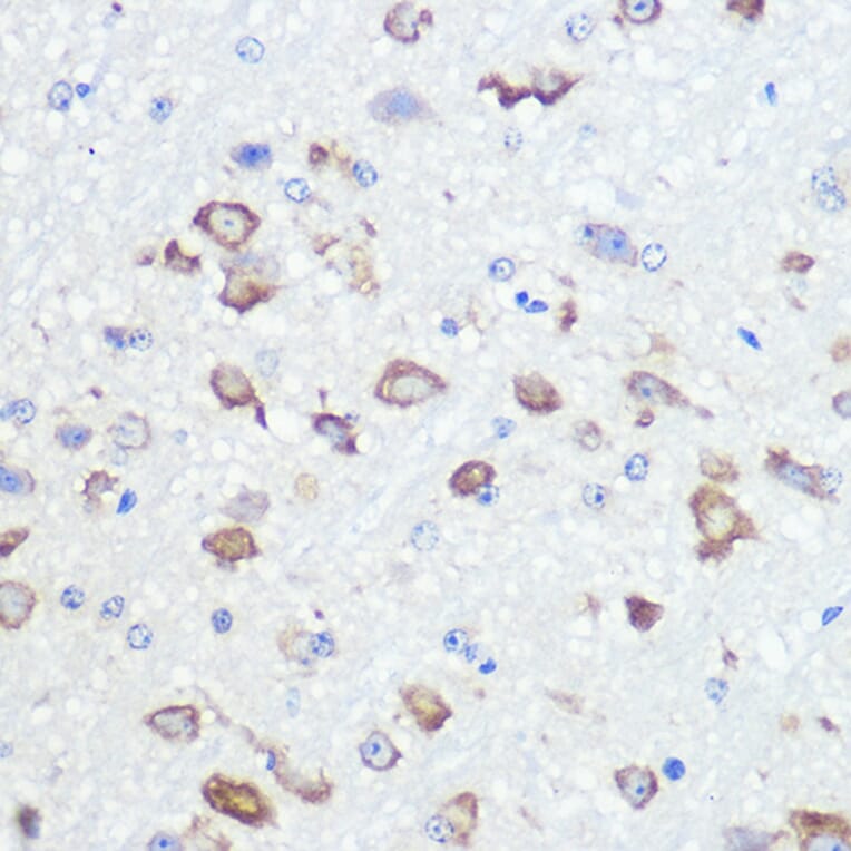 Immunohistochemistry - Anti-Ionotropic Glutamate receptor 2 Antibody [ARC0572] (A81034) - Antibodies.com