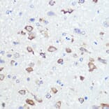 Immunohistochemistry - Anti-Ionotropic Glutamate receptor 2 Antibody [ARC0572] (A81034) - Antibodies.com