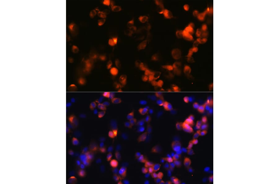 Immunofluorescence - Anti-Ionotropic Glutamate receptor 2 Antibody [ARC0572] (A81034) - Antibodies.com