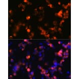 Immunofluorescence - Anti-Ionotropic Glutamate receptor 2 Antibody [ARC0572] (A81034) - Antibodies.com