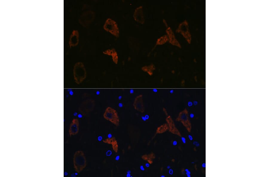 Immunofluorescence - Anti-Ionotropic Glutamate receptor 2 Antibody [ARC0572] (A81034) - Antibodies.com
