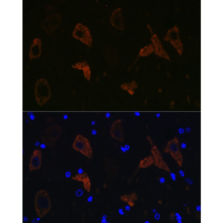 Immunofluorescence - Anti-Ionotropic Glutamate receptor 2 Antibody [ARC0572] (A81034) - Antibodies.com