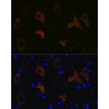 Immunofluorescence - Anti-Ionotropic Glutamate receptor 2 Antibody [ARC0572] (A81034) - Antibodies.com