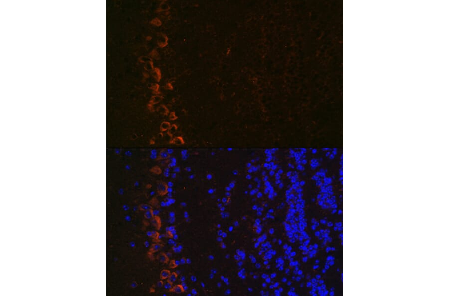Immunofluorescence - Anti-Ionotropic Glutamate receptor 2 Antibody [ARC0572] (A81034) - Antibodies.com