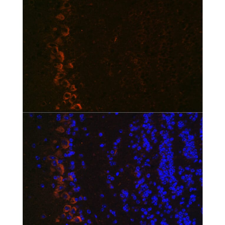 Immunofluorescence - Anti-Ionotropic Glutamate receptor 2 Antibody [ARC0572] (A81034) - Antibodies.com