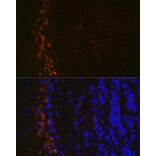 Immunofluorescence - Anti-Ionotropic Glutamate receptor 2 Antibody [ARC0572] (A81034) - Antibodies.com