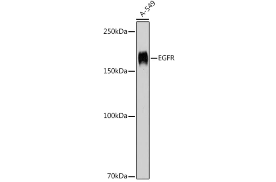 Western Blot - Anti-EGFR Antibody (A81037) - Antibodies.com