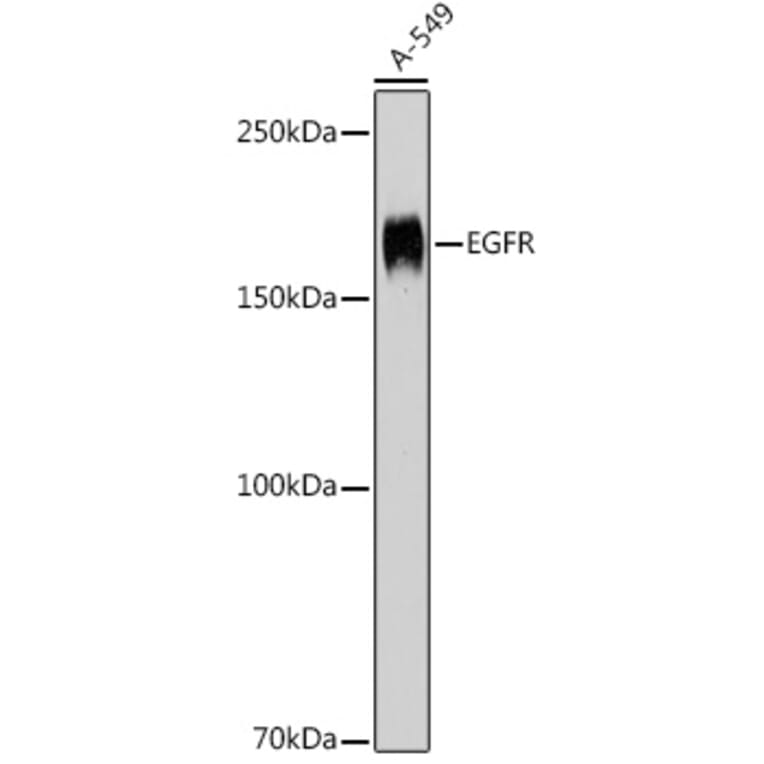 Western Blot - Anti-EGFR Antibody (A81037) - Antibodies.com