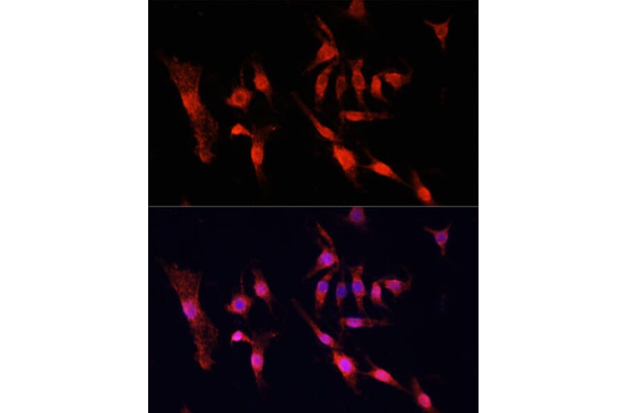 Immunofluorescence - Anti-EGFR Antibody (A81037) - Antibodies.com
