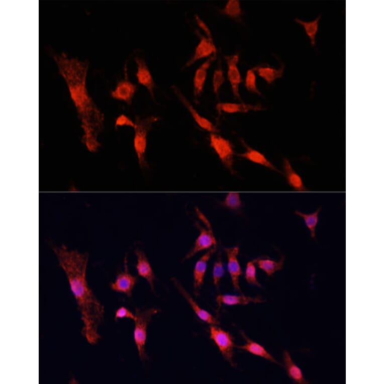 Immunofluorescence - Anti-EGFR Antibody (A81037) - Antibodies.com
