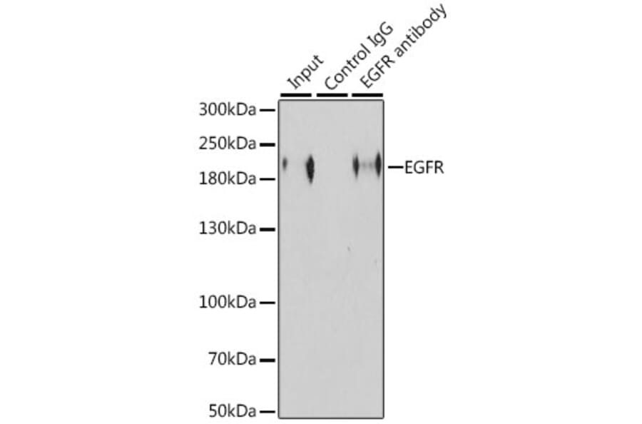 Western Blot - Anti-EGFR Antibody (A81037) - Antibodies.com