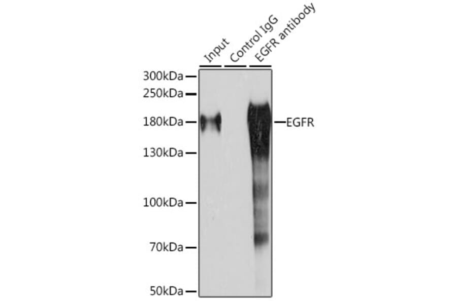 Western Blot - Anti-EGFR Antibody (A81037) - Antibodies.com