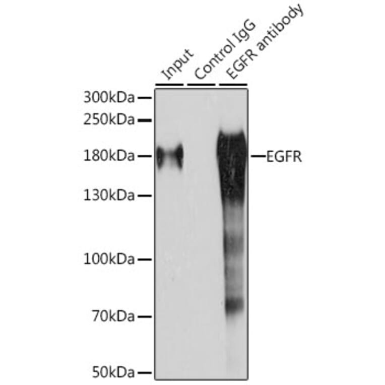 Western Blot - Anti-EGFR Antibody (A81037) - Antibodies.com