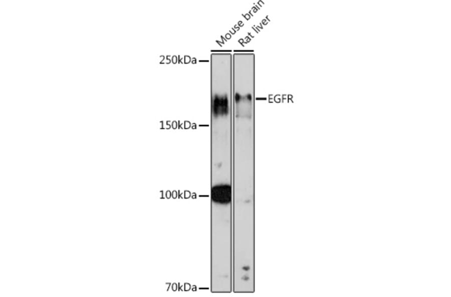 Western Blot - Anti-EGFR Antibody (A81037) - Antibodies.com