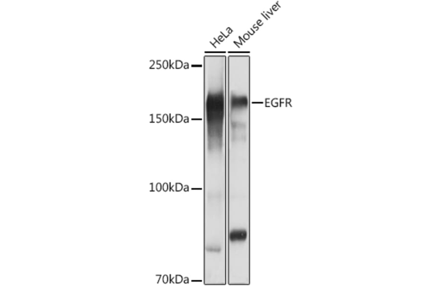 Western Blot - Anti-EGFR Antibody (A81037) - Antibodies.com